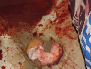 Penis ripped off woman 728X553 jpeg