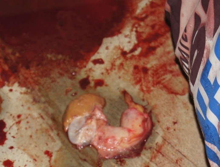 Penis ripped off woman full size
