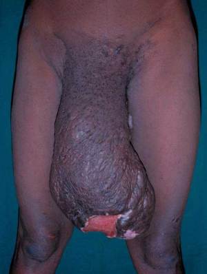 World s biggest dick 507X674 jpeg