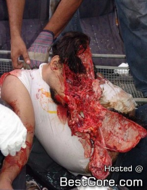 Man with head blown off 464X600 jpeg