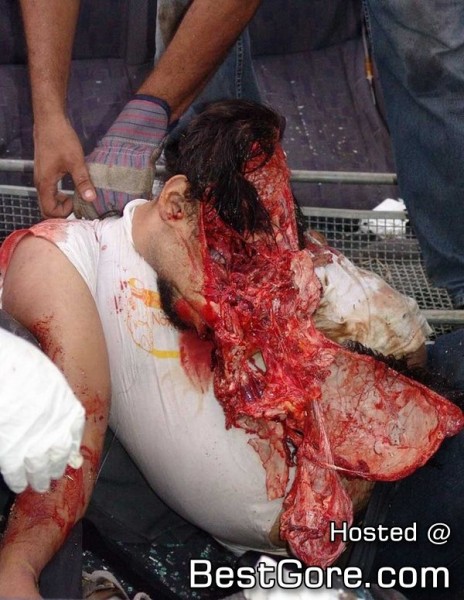 Man with head blown off full size