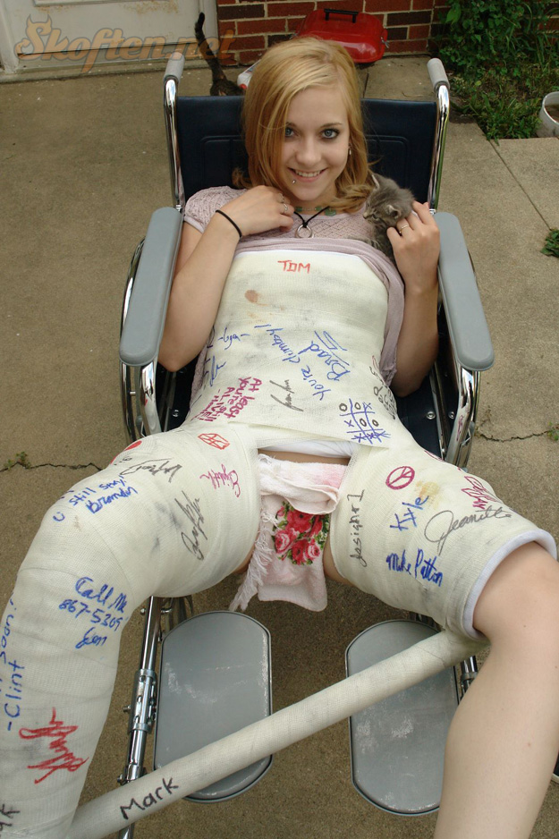 Crazy body cast image full size