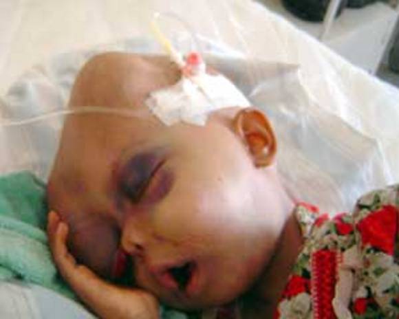 Birth defects from smoking full size