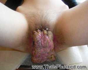 Vagina nasty ugly pussy 600X474 jpeg