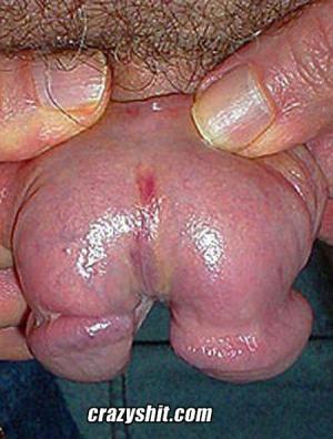 Split penis 450X595 jpeg