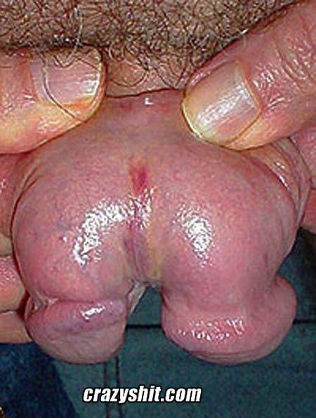 Split penis full size