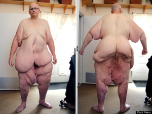 World s fattest man paul 570X426 jpeg