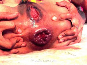 Bloody anal fisting 640X480 jpeg