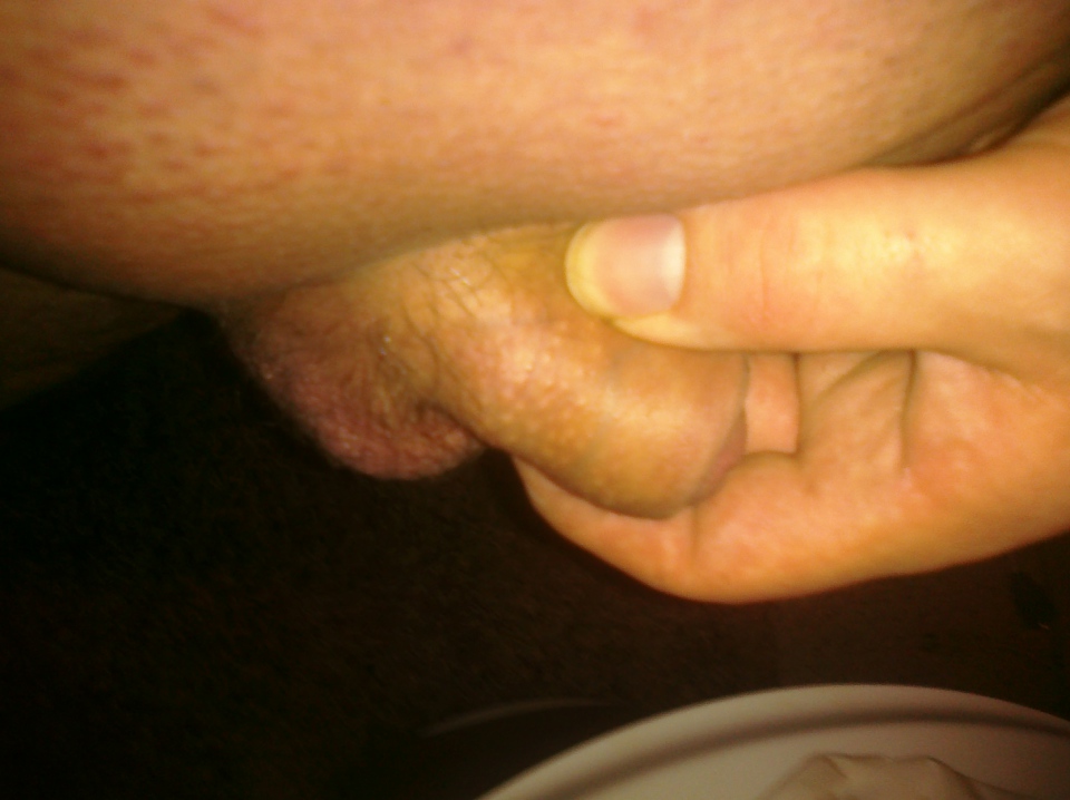Weird shaped penis full size