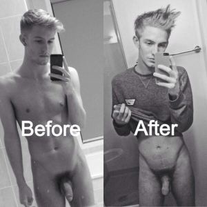 Foreskin restoration before after 620X620 jpeg