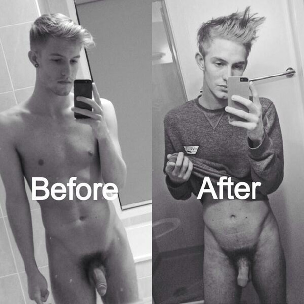 Foreskin restoration before after full size