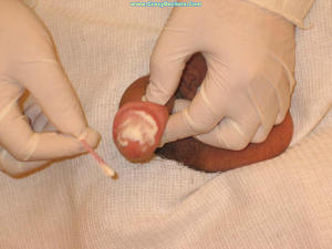 Gay male medical 960X720 jpeg