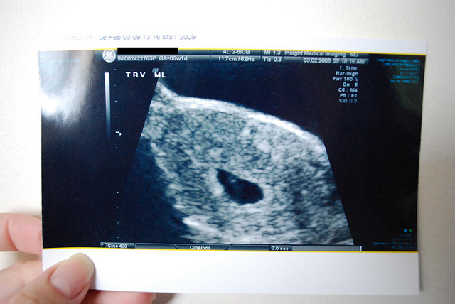 6 weeks pregnant ultrasound full size