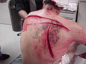 Justin bieber back knife wounds 640X480 jpeg