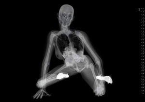 X ray calendar 960X675 jpeg