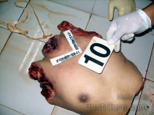Women breast nipples cut off 560X420 jpeg
