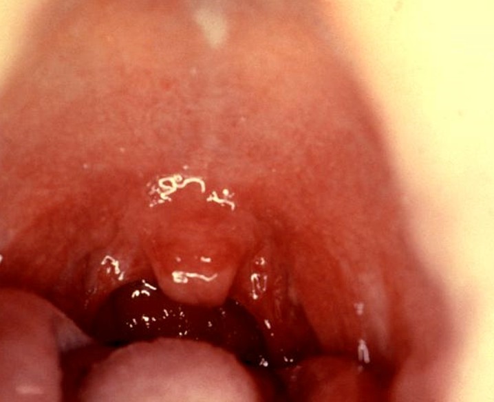 Strep throat bacteria full size