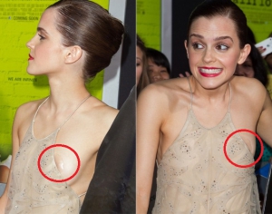 Emma watson celebrity wardrobe malfunctions 635X500 jpeg