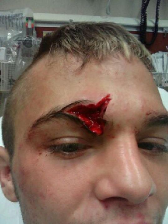 Worst mma cuts full size