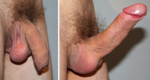 Flaccid and erect penis 960X515 jpeg