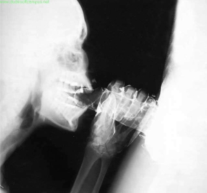 Xray deep throat blowjob 638X599 jpeg