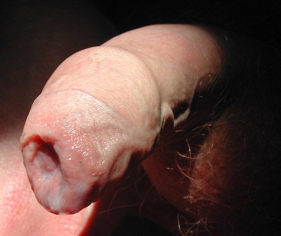 Adult male circumcision penis full size