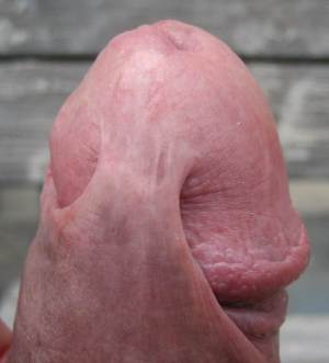 Foreskin on penis skin bridge 724X800 jpeg