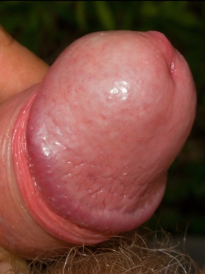 Image fap collection glans penis 960X1280 jpeg