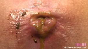 Japanese anal sex shit 960X540 jpeg