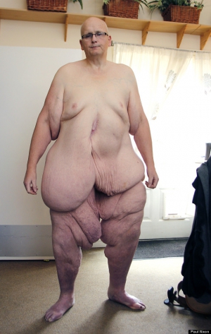 World fattest man paul mason 570X900 jpeg