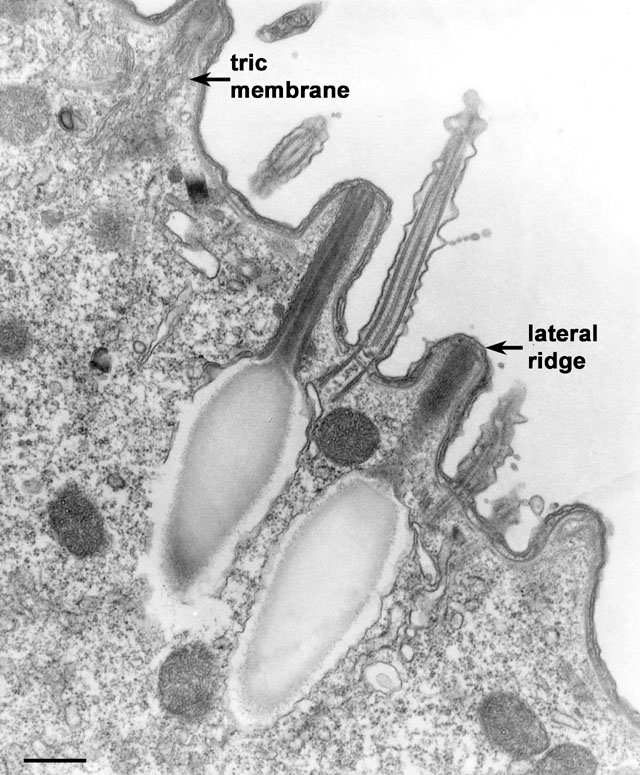Paramecium trichocysts discharged full size