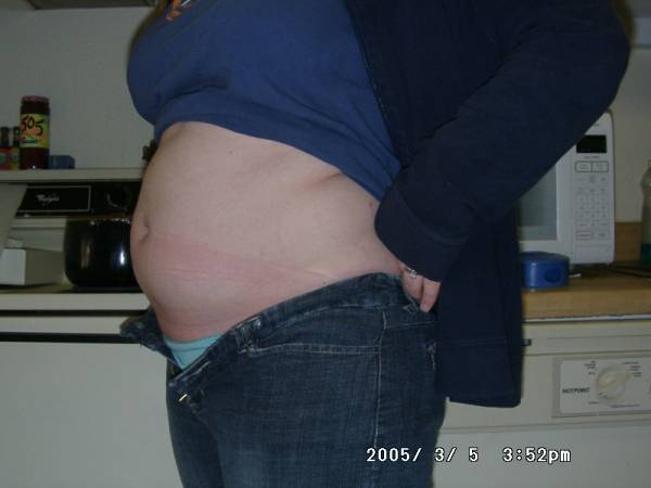 10 weeks pregnant belly full size