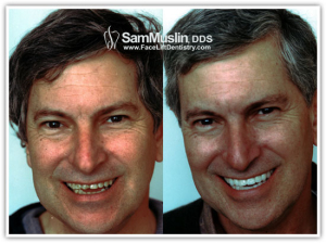 Face reconstruction before and after 550X412 jpeg