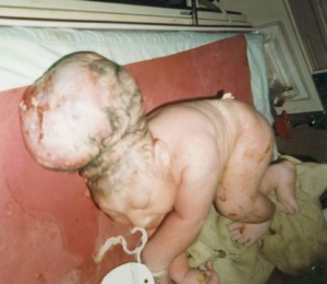 Chernobyl deformed people 555X481 jpeg