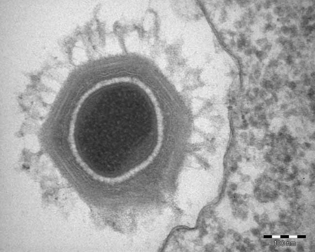 Mimivirus virus full size