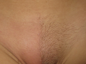 Brazilian wax pubic hair removal 604X453 jpeg