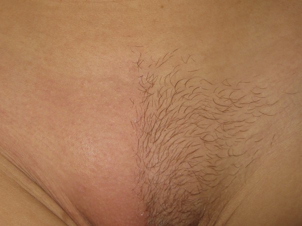 Brazilian wax pubic hair removal full size