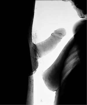 X ray porn 400X486 jpeg
