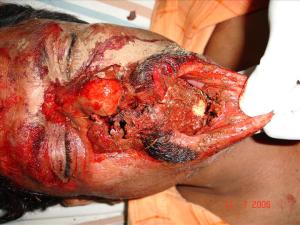 Facial trauma reconstruction 720X540 jpeg