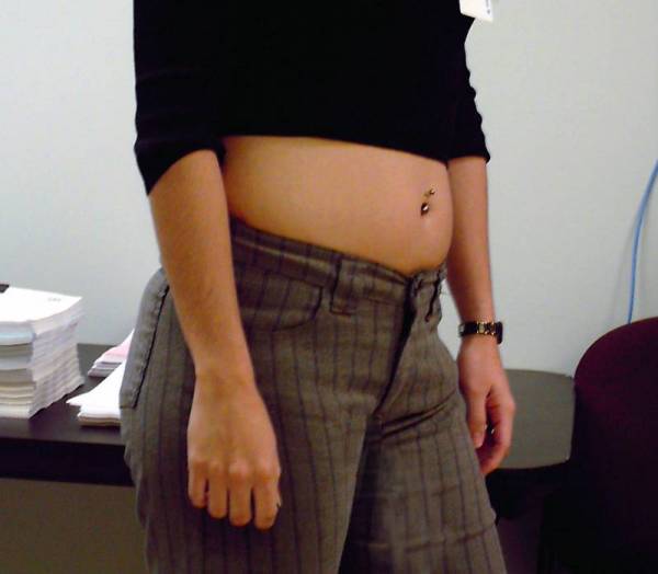 8 weeks pregnant belly full size