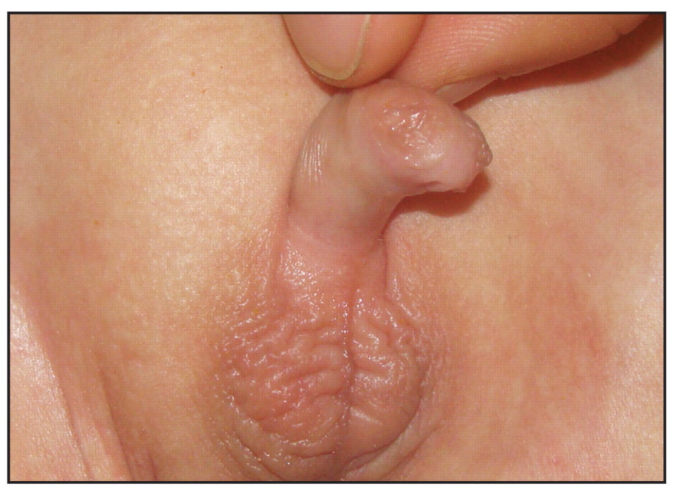 Micro penis full size