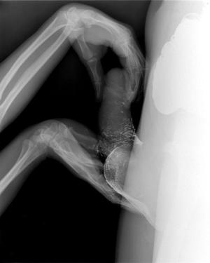 X ray people having sex 768X960 jpeg