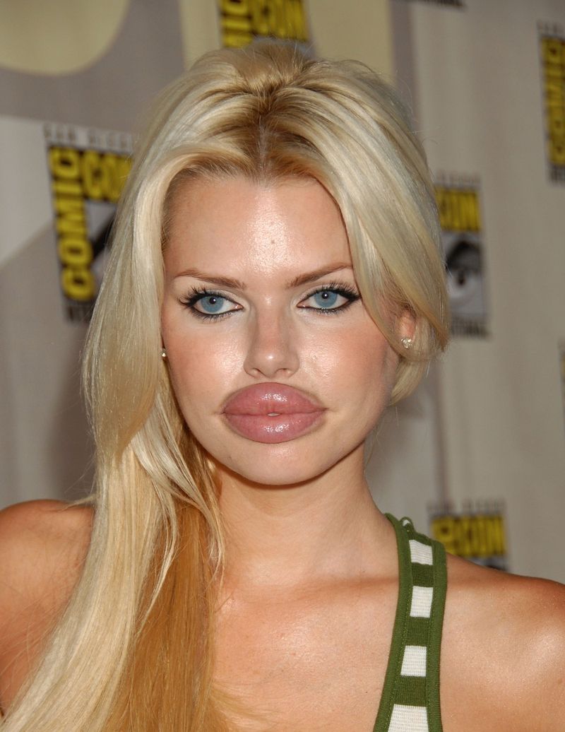 Plastic surgery gone bad full size