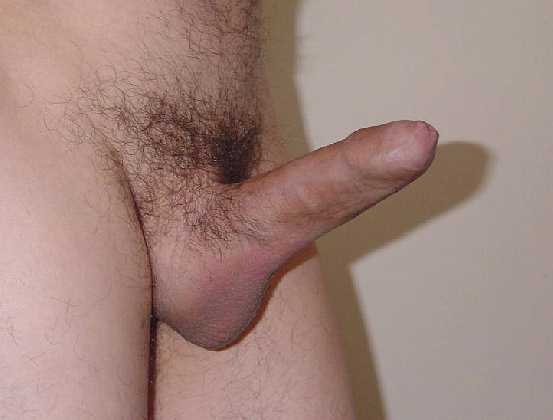 Penis foreskin phimosis full size