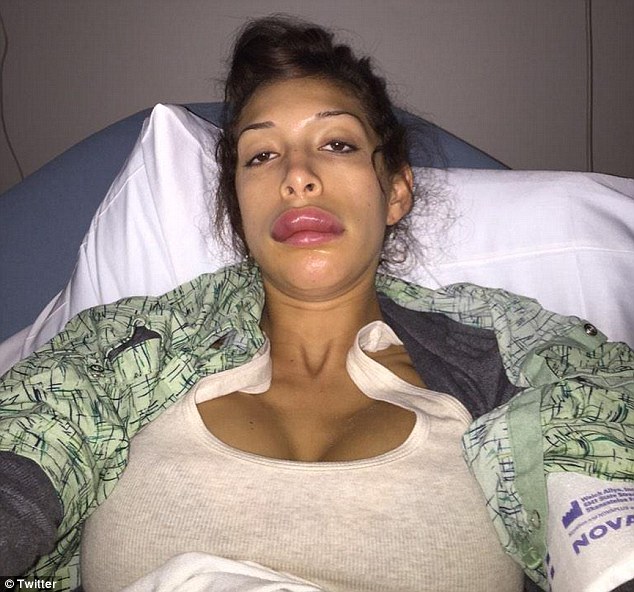 Farrah abraham lips botched full size