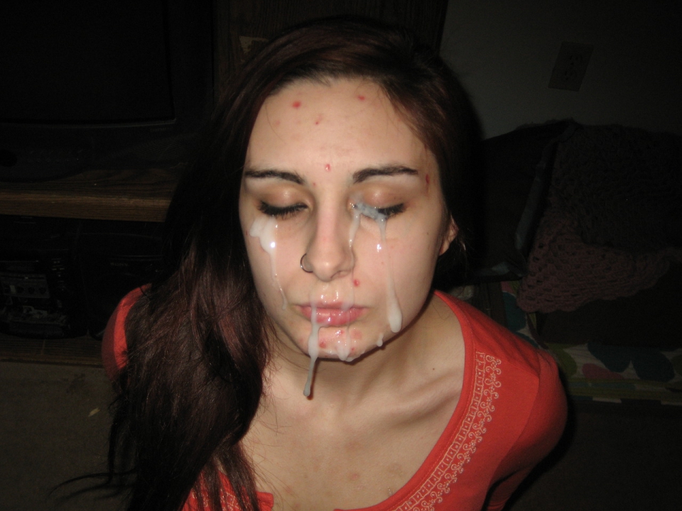 Acne cum facial full size