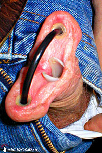 Penis split open full size