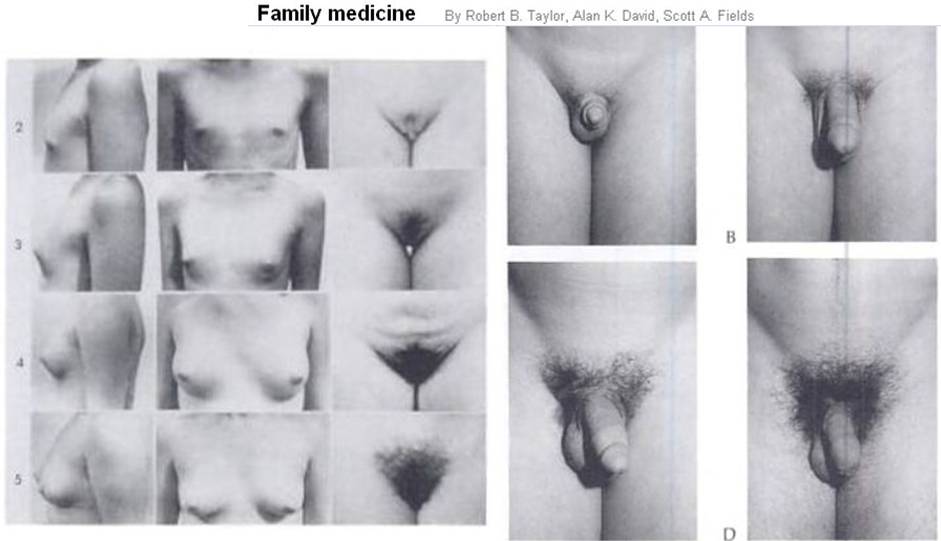 Tanner stage puberty full size