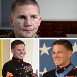 Kyle carpenter before and after surgery 960X960 jpeg