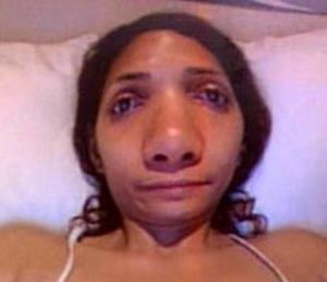 Person with big nose jewish 468X404 jpeg